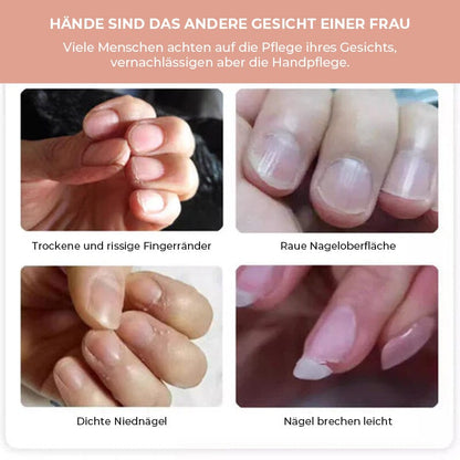 Vier Nahaufnahmen von Problemnägeln: trockene Fingerränder, raue Nagelfläche, Niednägel und leicht brechende Nägel 3