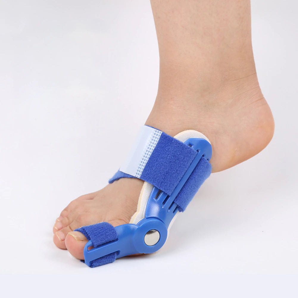 Blauer Hallux-Valgus-Korrektor am Fuß, orthopädische Schiene zur Zehenkorrektur.