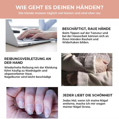 Collage zu beanspruchten Händen: Tippen am Laptop, Reibung durch Kleidung und brüchige, beschädigte Nägel 6