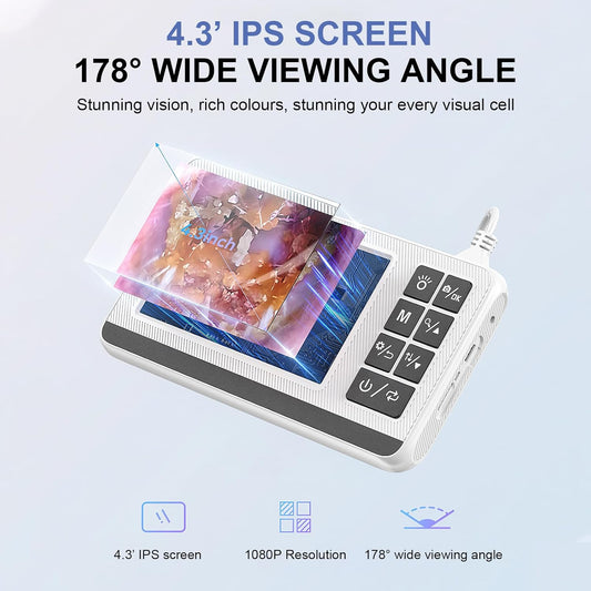 Ohrreinigungsohrmikroskop mit 3,9 mm Kamera und 4,3-Zoll HD-Bildschirm – Claryon