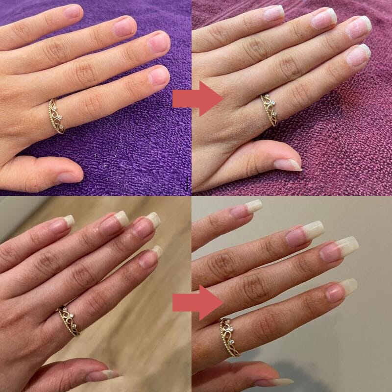 Zwei Vorher-Nachher-Paare einer Hand mit goldenem Ring, die Nägel wirken nach der Anwendung länger und gepflegter 9