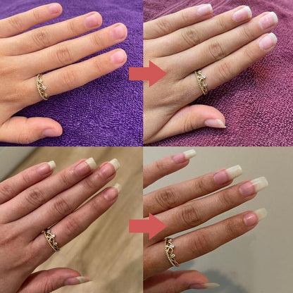 Zwei Vorher-Nachher-Paare einer Hand mit goldenem Ring, die Nägel wirken nach der Anwendung länger und gepflegter 9