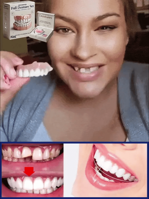 Flexible Denture Set for Upper & Lower Jaw – Reusable & Custom-Fit