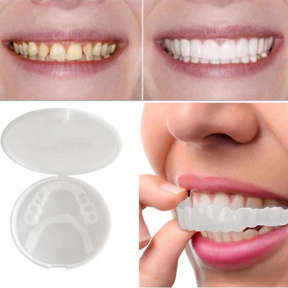 Vorher-nachher-Vergleich gelblicher und weißer Zähne, dazu die geöffnete Aufbewahrungsdose mit Veneers und ein Finger beim Aufsetzen. 4