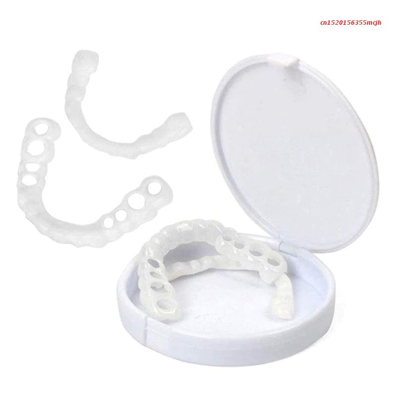 Snap-On Veneers | Flexible No-Glue Fit for Meals and Daily Wear 4