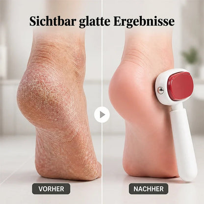 Vorher-nachher-Vergleich: rissige, trockene Ferse links, glatte Ferse rechts mit angesetztem Hornhautentferner 2