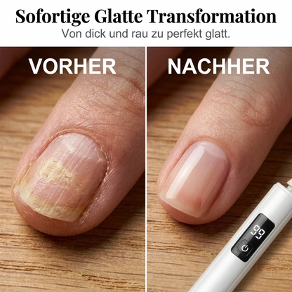 Elektrisches Präzisions Nagelpflegeset mit 4 Aufsätzen